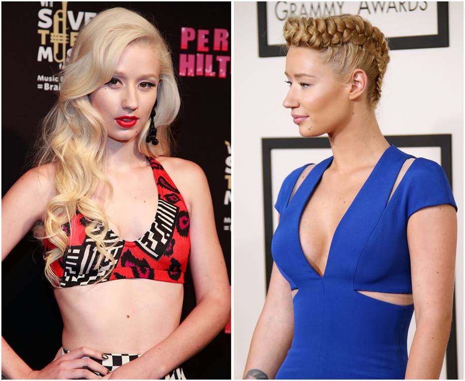 Iggy Azalea Before and After