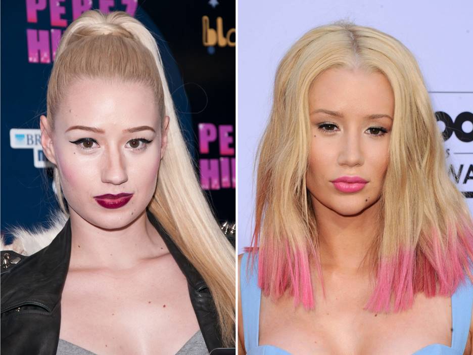 Iggy Azalea Before and After