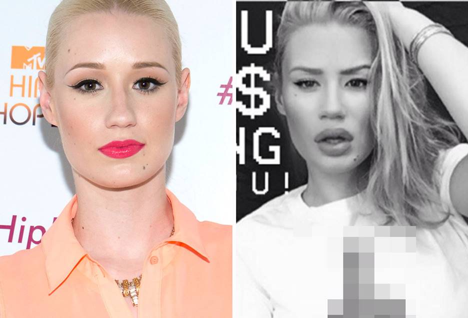 Iggy Azalea Before and After