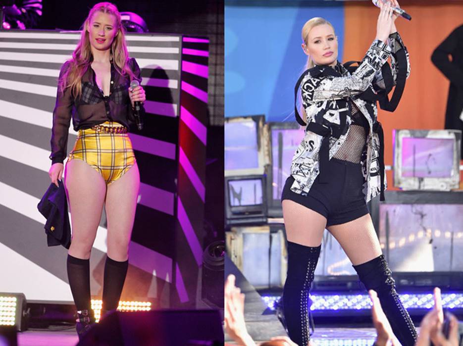 Iggy Azalea Before and After